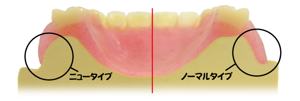 ds-denture